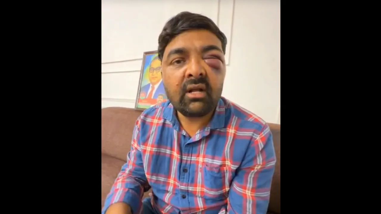 ‘Tortured For Hours’: SP Leader Alleges Police Brutality, Probe Ordered In Meerut