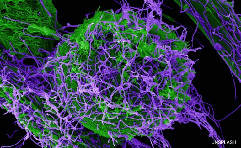 Chinese Scientists Create Ebola Virus In Lab That Causes Horrific Symptoms