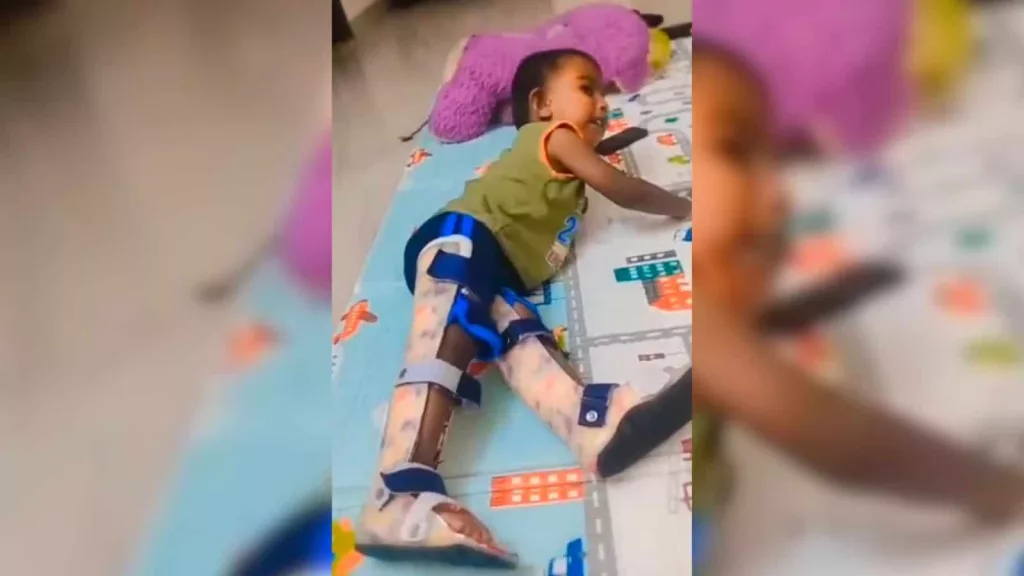 Telangana CM assures treatment for baby with SMA