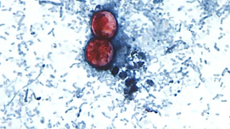 Diarrhea-causing parasite that can contaminate raw produce causing misery across several states